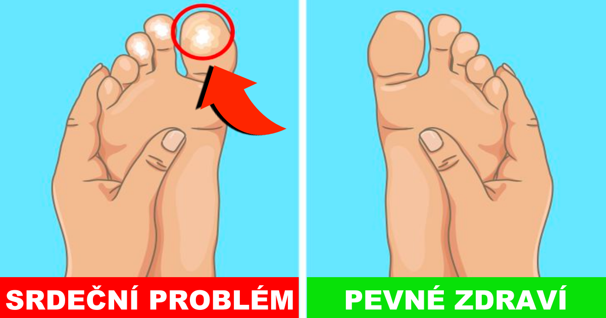 Co vám nohy prozradí o vašem zdraví JakZdravě cz