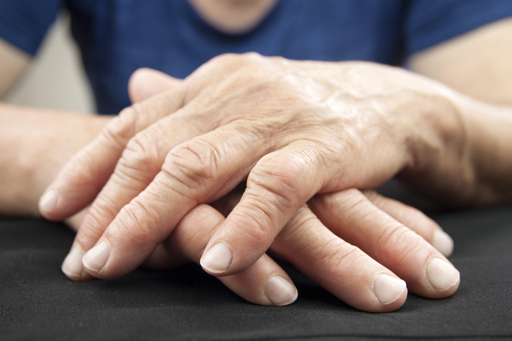 Revmatoidní artritida postihující ruce