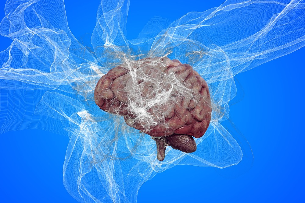 frontotemporální demence, obrázek mozku