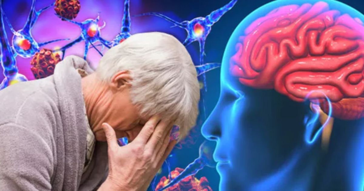 5 Příznaků Alzheimerovy Choroby Které Nesmíte Podcenit 3963