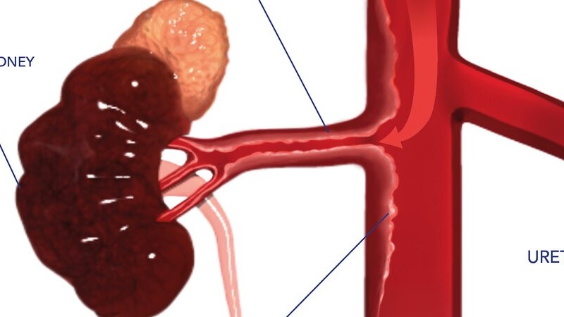 Na Poruchu Nadledvinek M e Ukazovat Chu Na S l I Cukr Na Poruchu Nadledvinek M e Ukazovat Chu Na S l I Cukr