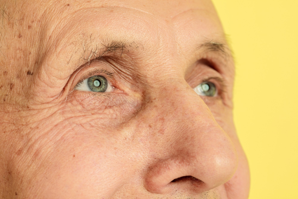 Detailní fotografie obličeje starého pána s pigmentovými skvrnami v oblasti spánku
