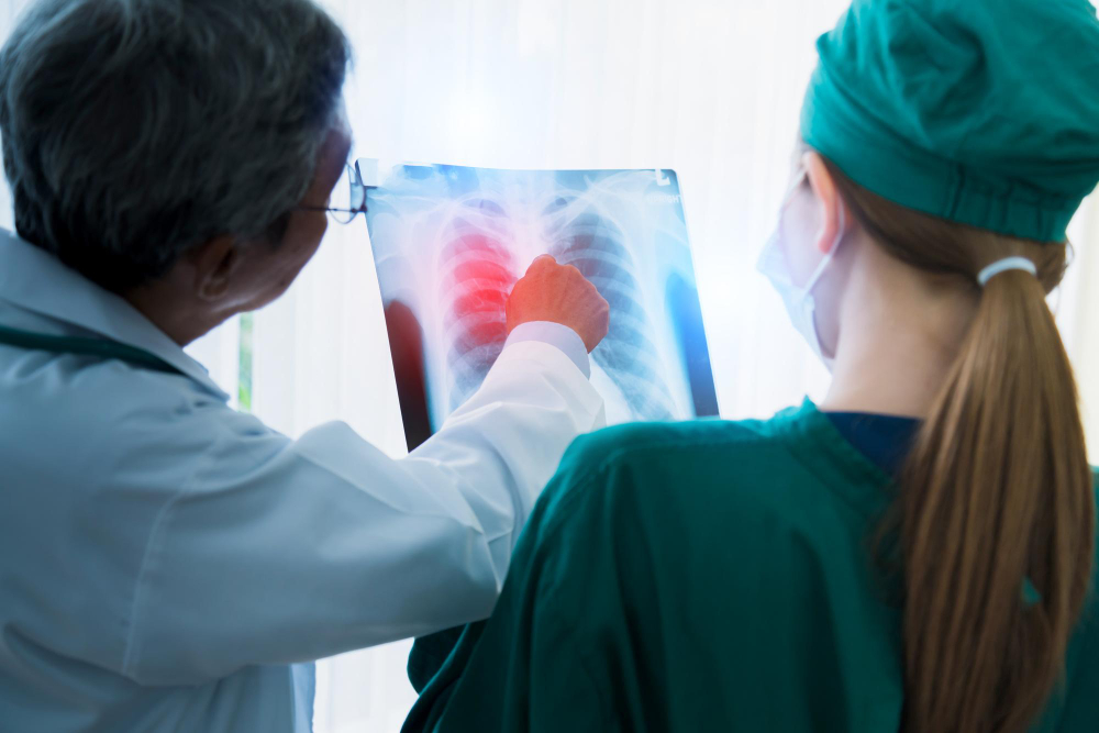 Dva lékaři studují rentgenový snímek plic